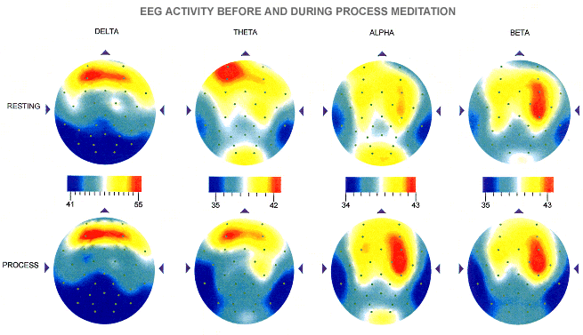 Brain-mapping (63Kb)